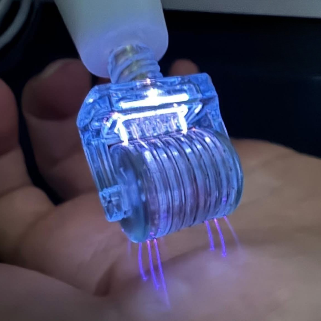 derma plasma tip