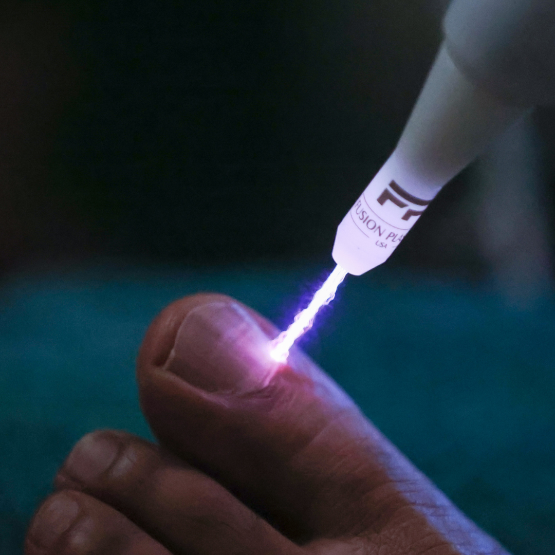 jet plasma tip