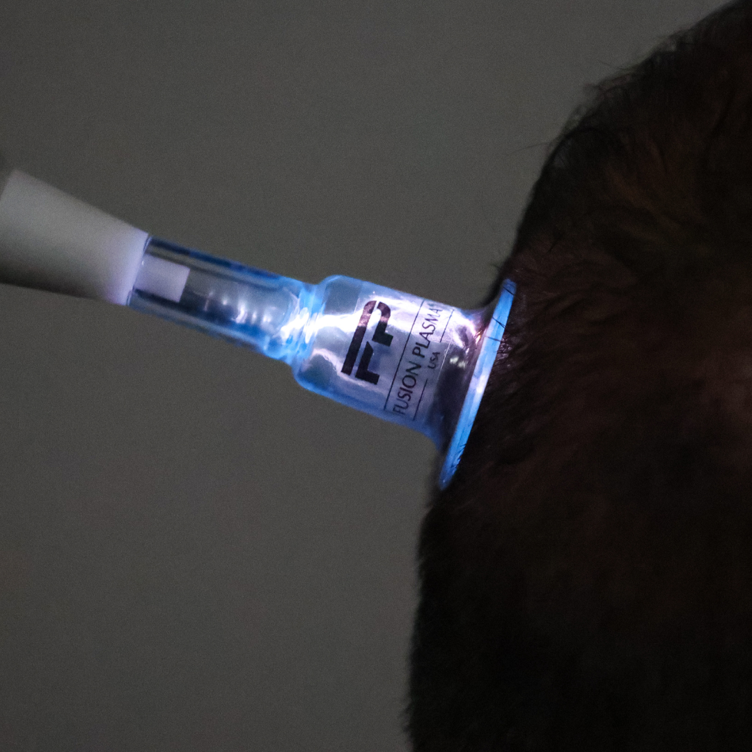 scalp plasma tip