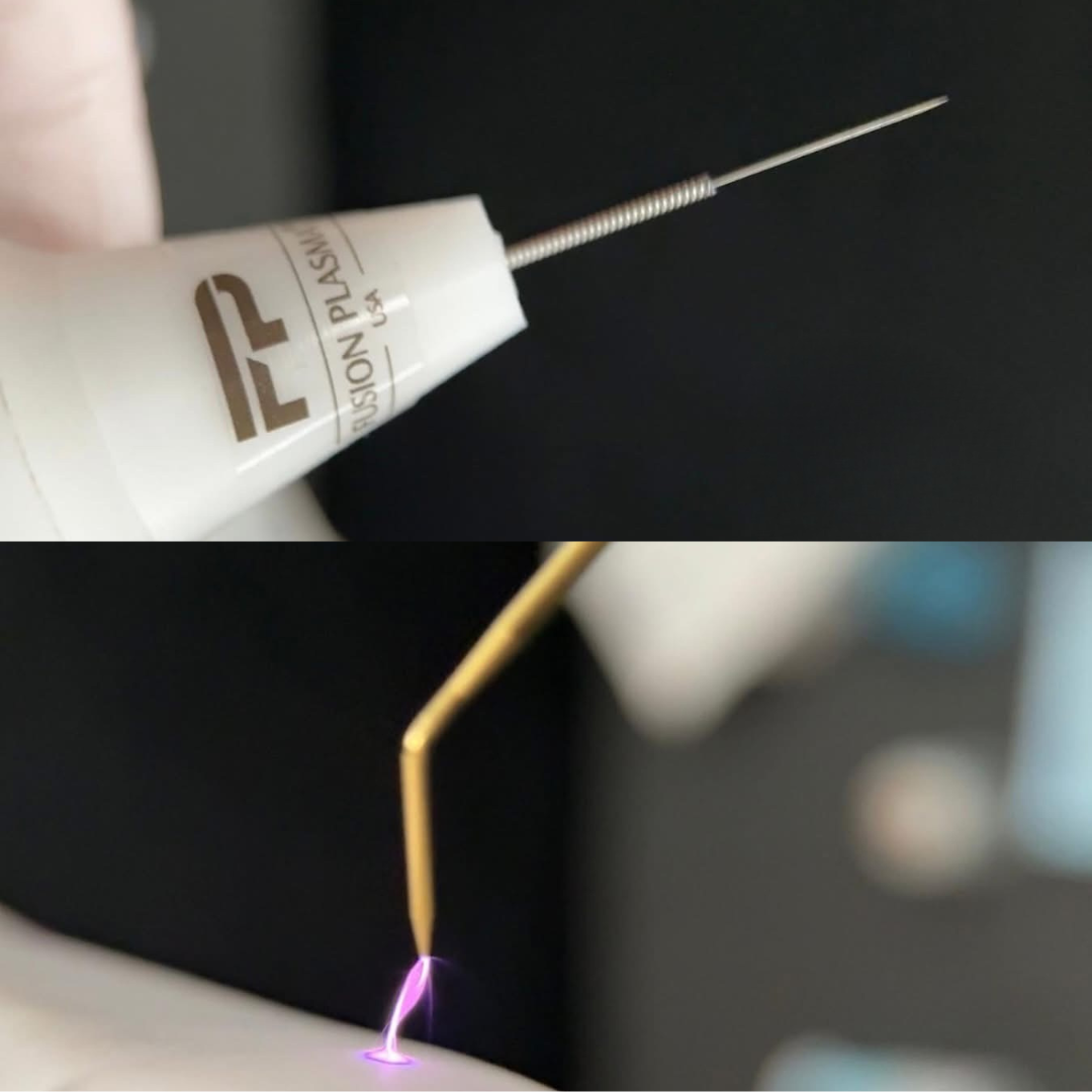 warm plasma needles